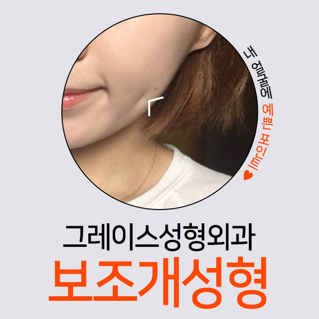 상큼함을 더해주는 보조개성형은 바로 여기! 관련 이미지 1