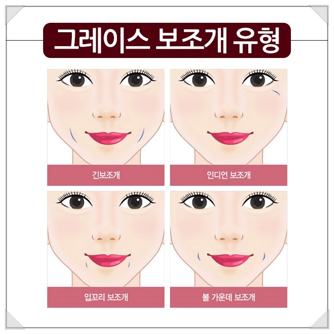 미소부터 달라 보여, 보조개수술후기 관련 이미지 3