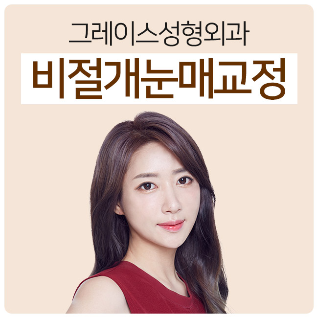 또렷한 눈의 비결, 비절개눈매교정♡ 관련 이미지 2