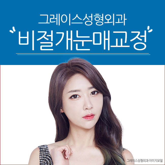 또렷한 눈매, 비절개눈매교정가격을 알아본다면 관련 이미지 1