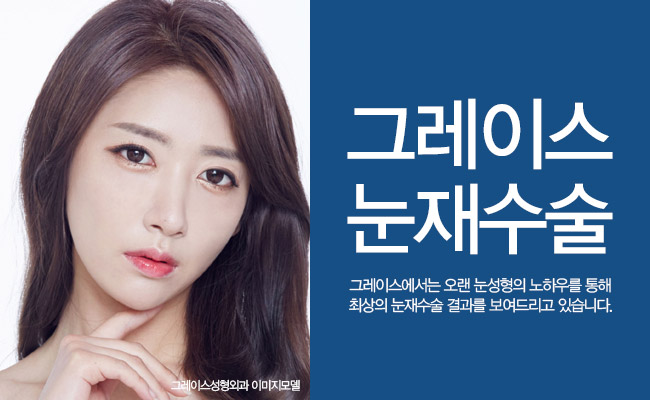 재발한 안검하수 그레이스성형외과에서 해결! 관련 이미지 6