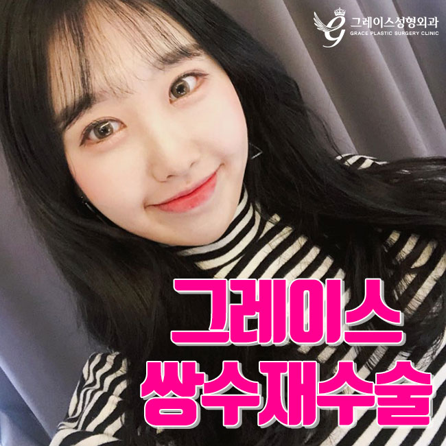 마지막 쌍수재수술 후기는 이곳에서 관련 이미지 1