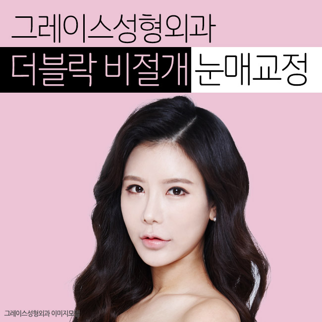 더블락 비절개눈매교정은 눈매교정잘하는곳, 그레이스성형외과에서 관련 이미지 6