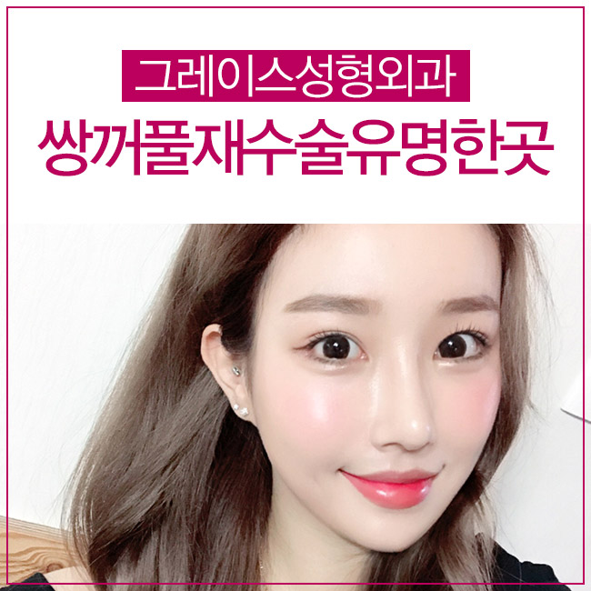 쌍꺼풀재수술유명한곳은 바로 여기지! 관련 이미지 5