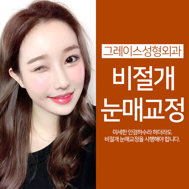 또렷한 눈의 비결, 비절개눈매교정♡ 관련 이미지 3