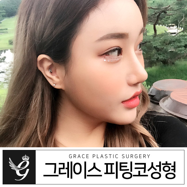 코수술후기는 움직임까지 부드러운 이곳이 정답! 관련 이미지 3