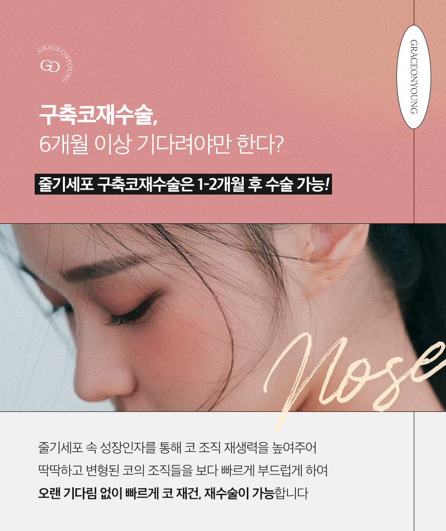 줄기세포치료와 구축코 재수술! 관련 이미지 1