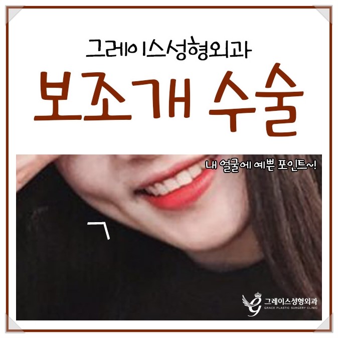 미소부터 달라 보여, 보조개수술후기 관련 이미지 1