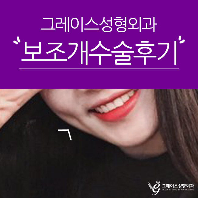 예쁜 보조개수술후기 만족스러워 관련 이미지 3