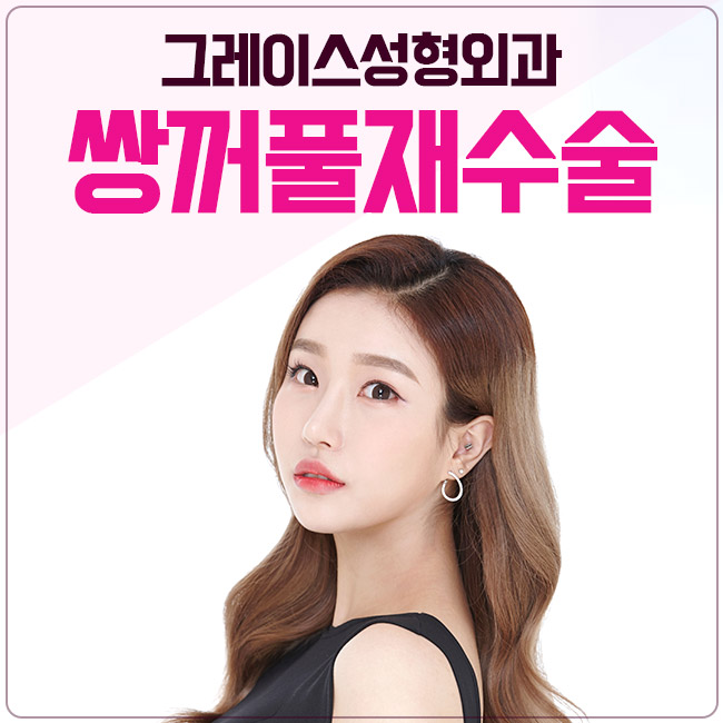 마지막 쌍수재수술 후기는 이곳에서 관련 이미지 2