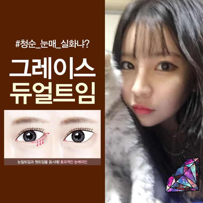 여기! 진정 선하고 예쁜 눈매를 선사하는 그레이스성형외과 듀얼트임! 관련 이미지 2