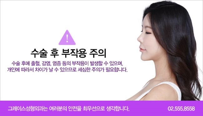 모티바가슴성형 모양과 촉감의 차이! 관련 이미지 8