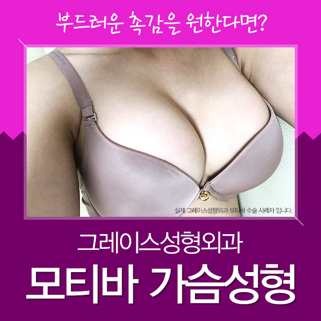 Satisfying Results in Breast Augmentation Feel with Motiva image 1