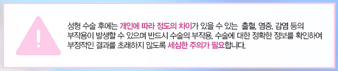 짝눈교정가격 내맘에 들도록 관련 이미지 12