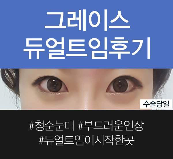 듀얼트임후기, 부드럽고 선한 이미지로 관련 이미지 3