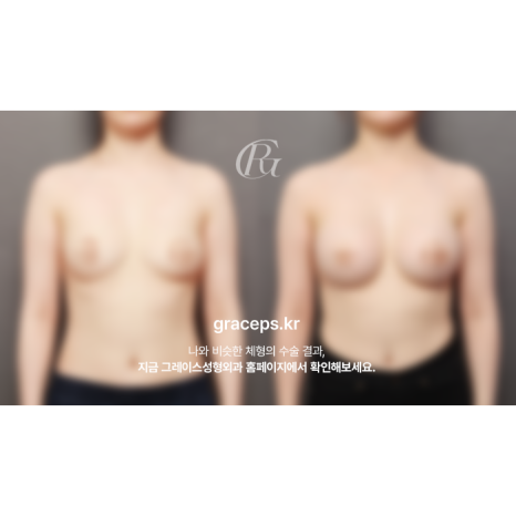 Where to Get Excellent Breast Surgery: You Need a Result That Fits You, Not Just a Before-and-After image 3