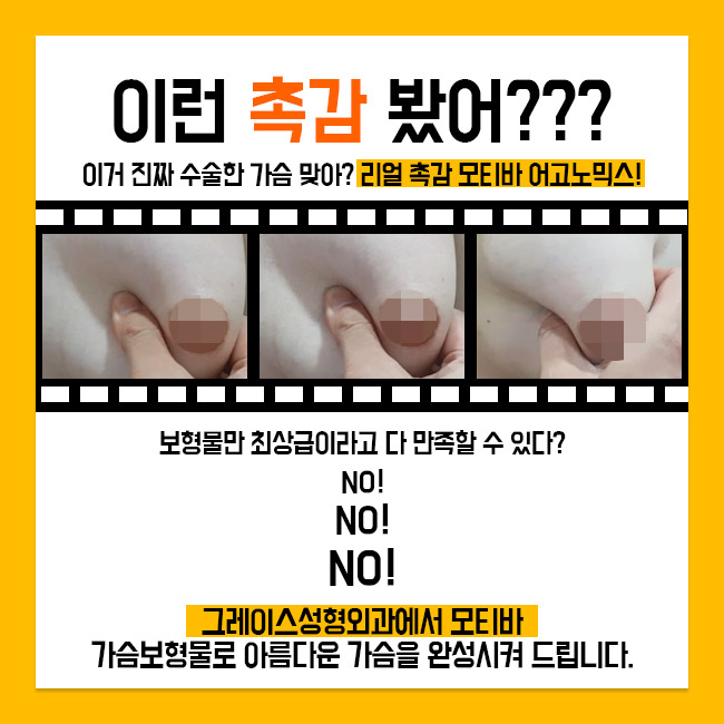 촉감 좋은 가슴보형물을 찾으신다면? 그레이스성형외과에서 모티바가슴성형 관련 이미지 3