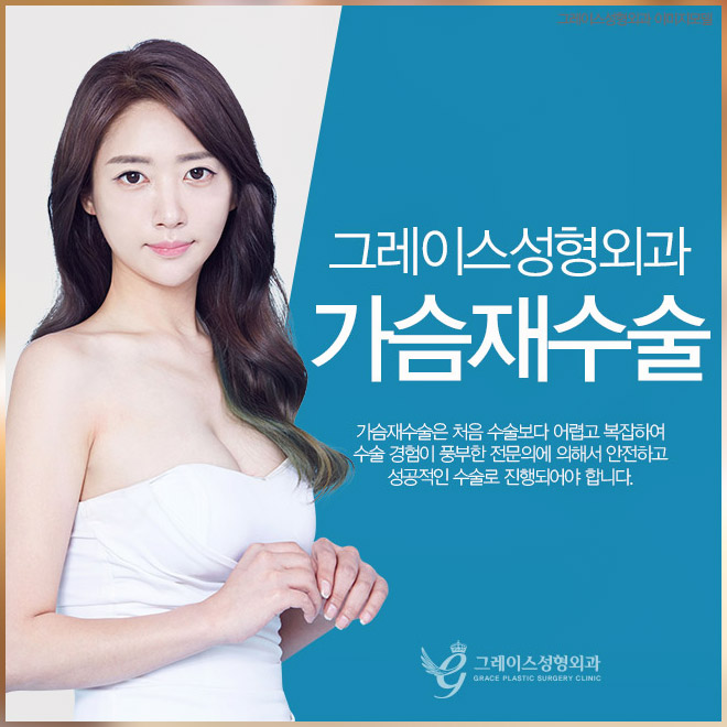 가슴성형재수술금액으로 고민 해결! 관련 이미지 2