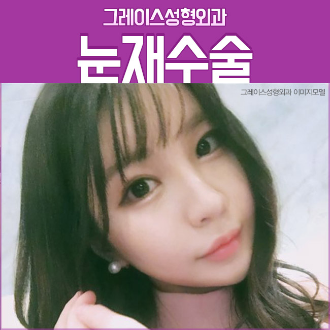 신사역 눈재수술잘하는곳, 그레이스성형외과 관련 이미지 2