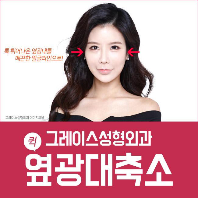 옆광대축소, 툭 튀어나온 옆광대를 부드럽게 관련 이미지 3