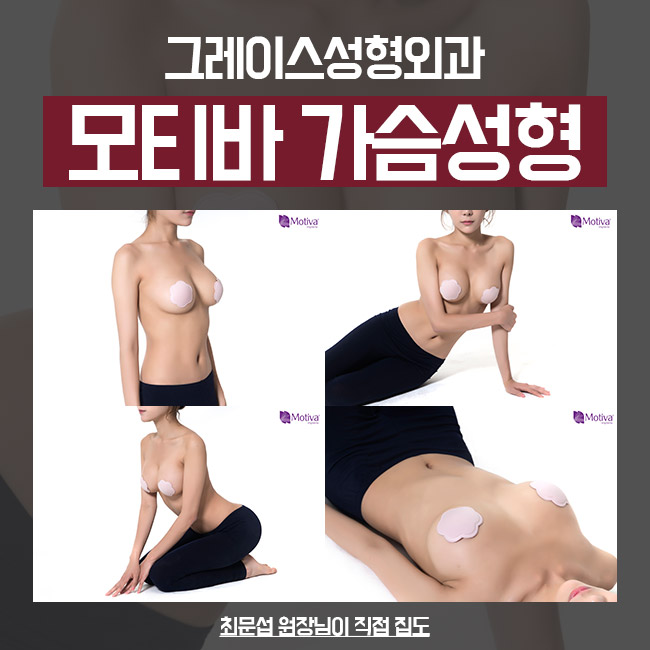 마이크로텍스쳐가슴성형, 모티바후기는 이곳에서! 관련 이미지 4