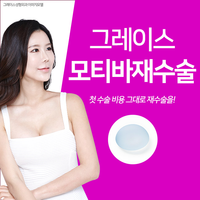 모티바재수술 만족스러운 후기 관련 이미지 1