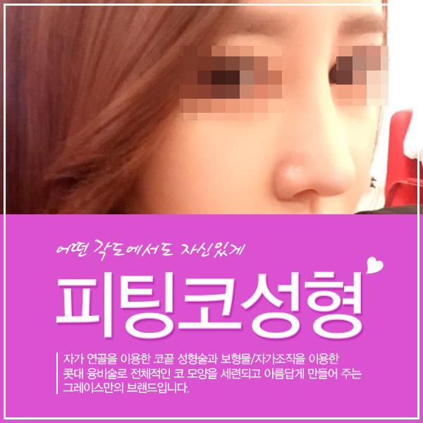 내 얼굴에 핏! 그레이스성형외과 피팅코성형 관련 이미지 1