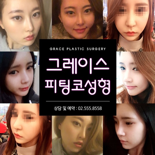 얼굴의 전체적인 밸런스를 고려한 그레이스성형외과 피팅코 관련 이미지 3