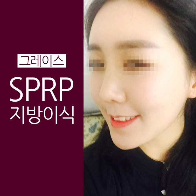 그레이스성형외과 PRP지방이식으로 예쁨을 채우다! 관련 이미지 1