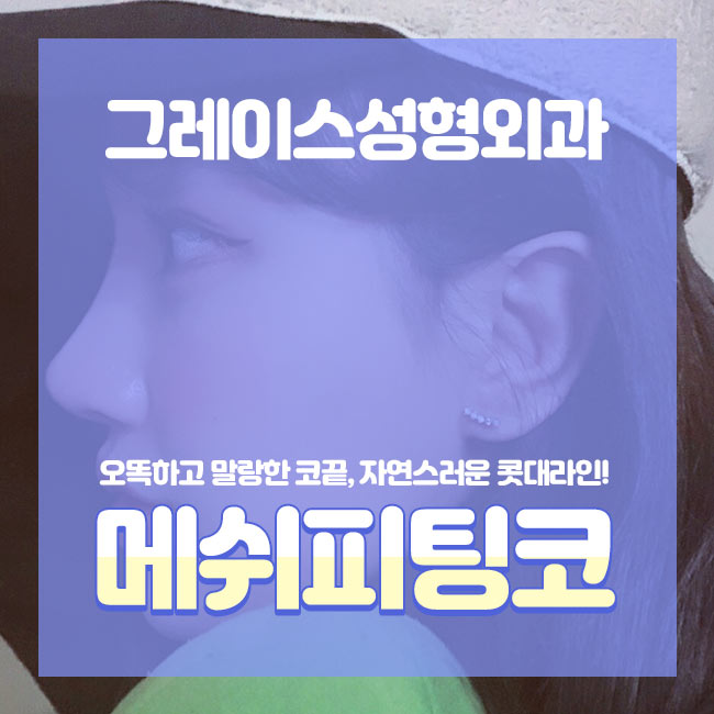 메쉬코성형 자연스러움과 오똑함을 동시에! 관련 이미지 1