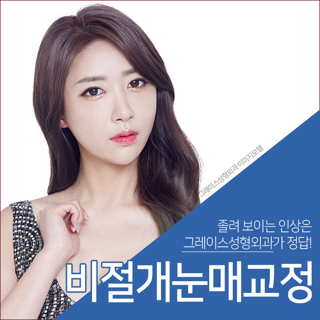 신뢰가 가는 비절개눈매교정가격은 바로 여기! 관련 이미지 2