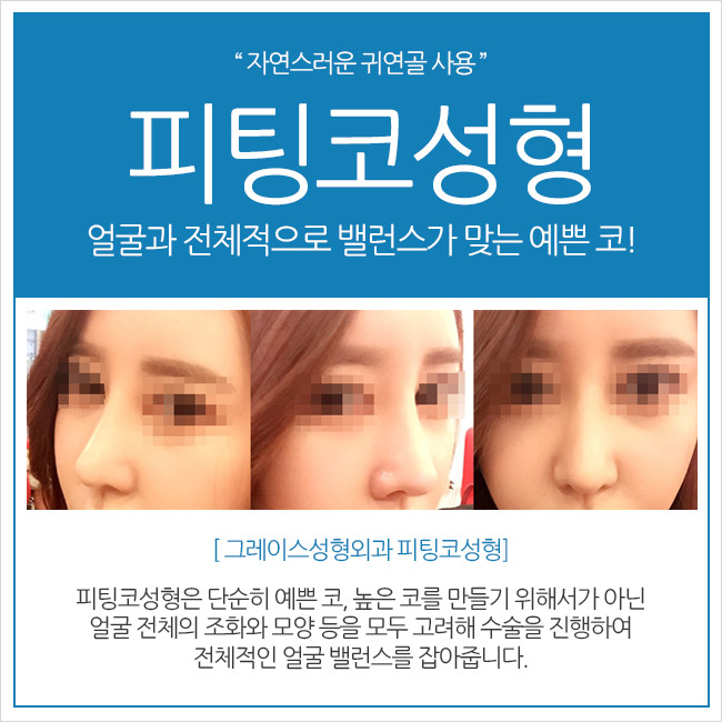 코성형잘하는곳, 그래! 그레이스성형외과 관련 이미지 3