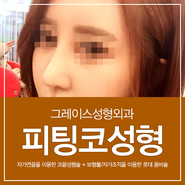그레이스성형외과 피팅코성형, 첫 코성형부터 코재수술까지 관련 이미지 1