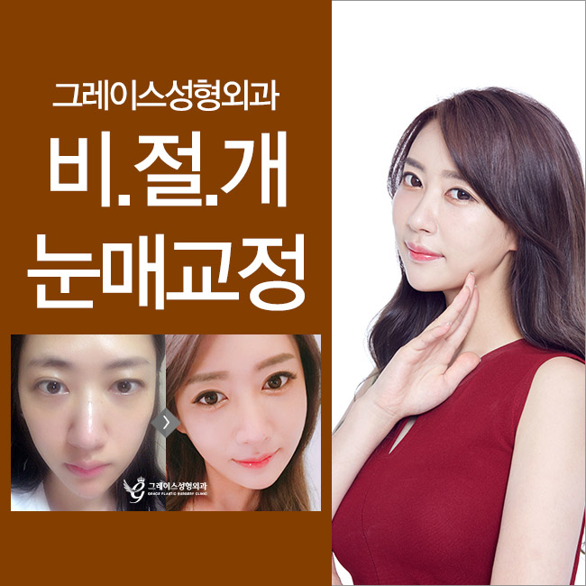 비절개눈매교정가격 만족스러운 후기까지 관련 이미지 4