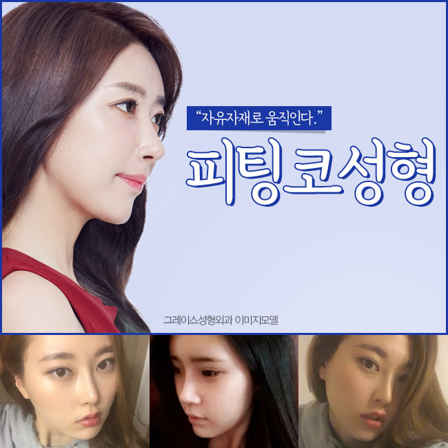 매일 버스에서 보던 코성형, 그레이스성형외과 피팅코성형 관련 이미지 5
