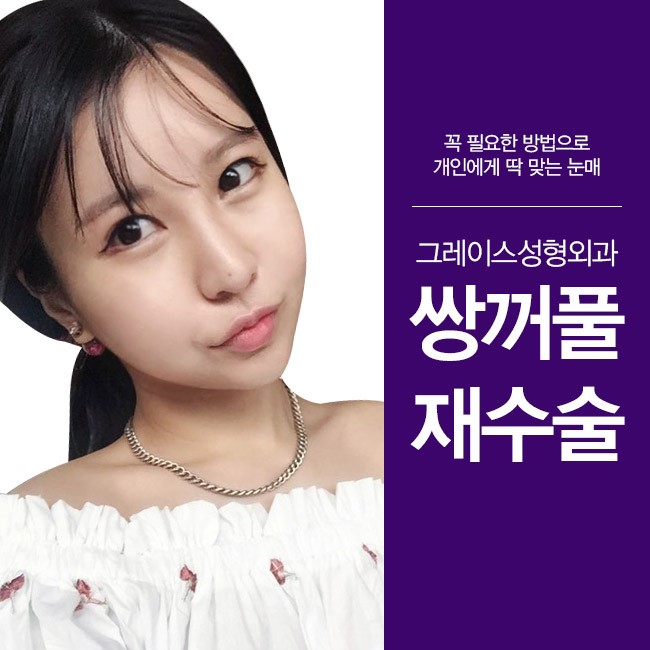 나에게 꼭 필요한 방법으로 그레이스성형외과 쌍꺼풀재수술 관련 이미지 5