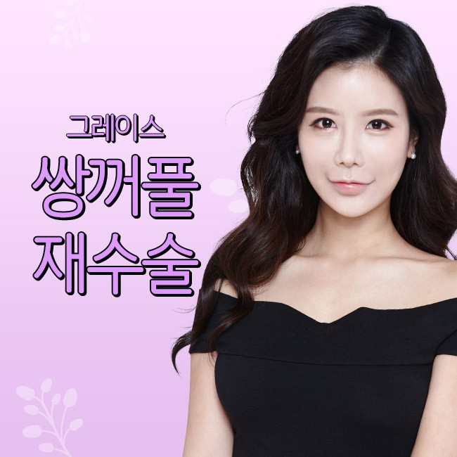 눈재수술의 현명한 선택, 그레이스성형외과 관련 이미지 2