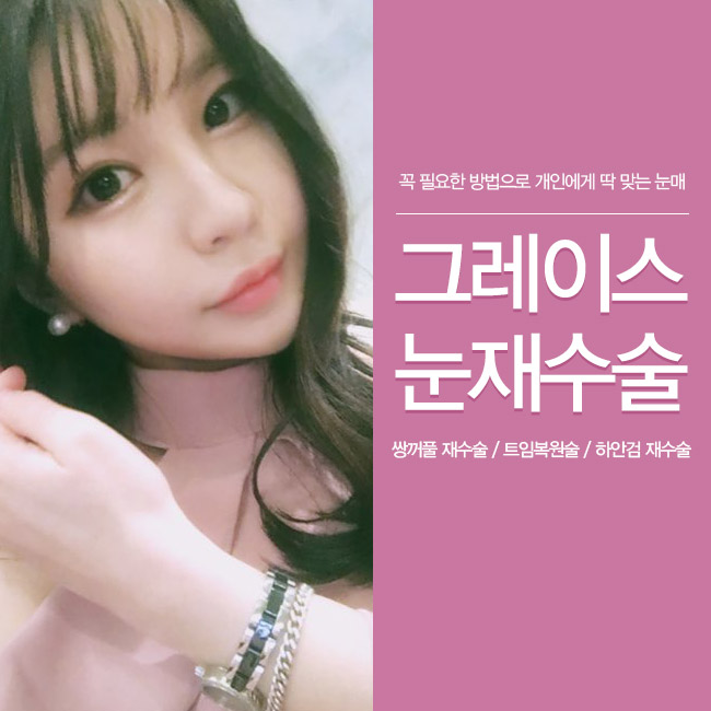 그레이스성형외과 눈재수술에 대해 알아보자! 관련 이미지 1