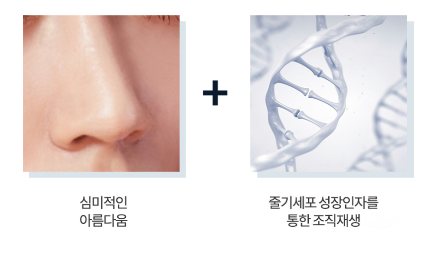 코재건수술, 구축코성형 치료방법 줄기세포치료 관련 이미지 1