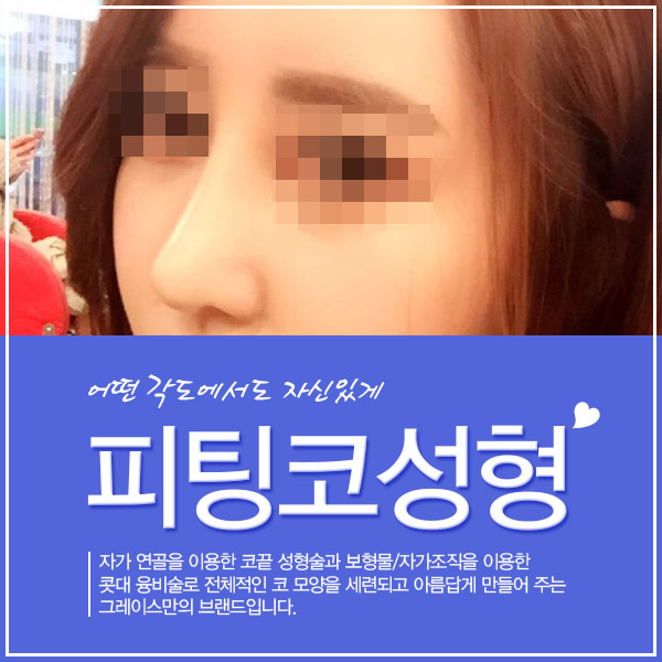 코성형후기, 그레이스성형외과 피팅코 관련 이미지 3