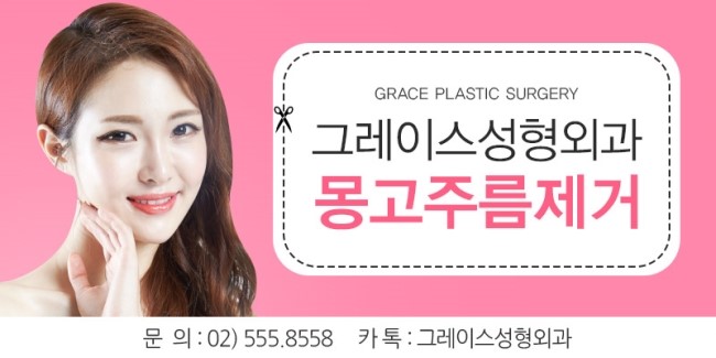 앞트임후기, 그레이스성형외과에서 알아보자! 관련 이미지 4
