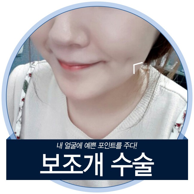 그레이스성형외과 김윤호원장님의 보조개수술 관련 이미지 4