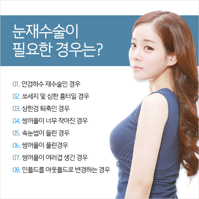 성공적인 쌍꺼풀재수술, 그레이스성형외과 관련 이미지 5