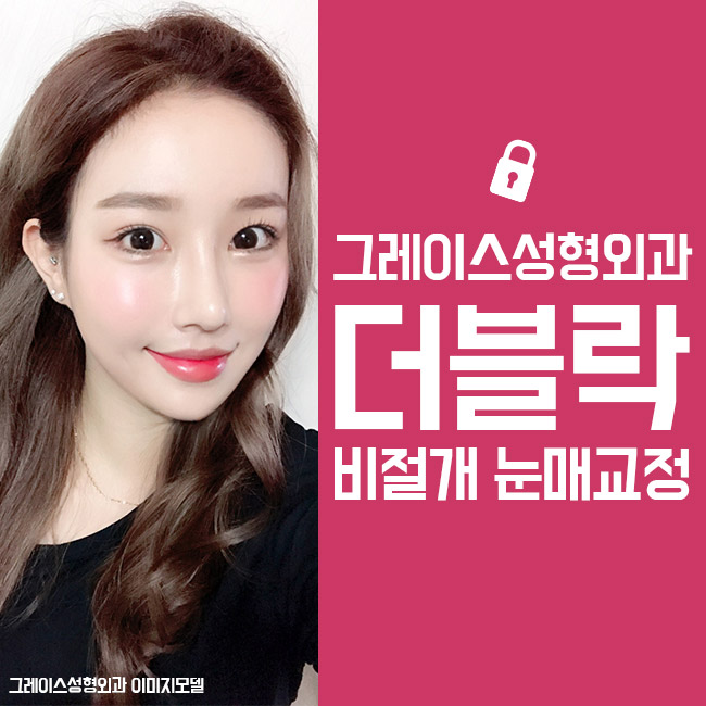 눈매교정잘하는곳, 신사역 그레이스성형외과 더블락 비절개눈매교정 관련 이미지 3