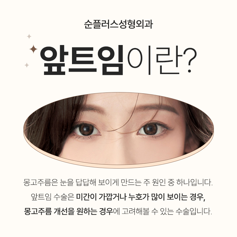 앞트임 통해 몽고주름 개선하고 또렷하게 관련 이미지 2