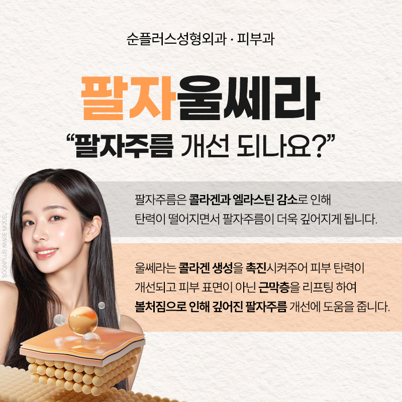 팔자주름, 울쎄라 레이저로 리프팅해 볼륨과 탄력 효과를 관련 이미지 3