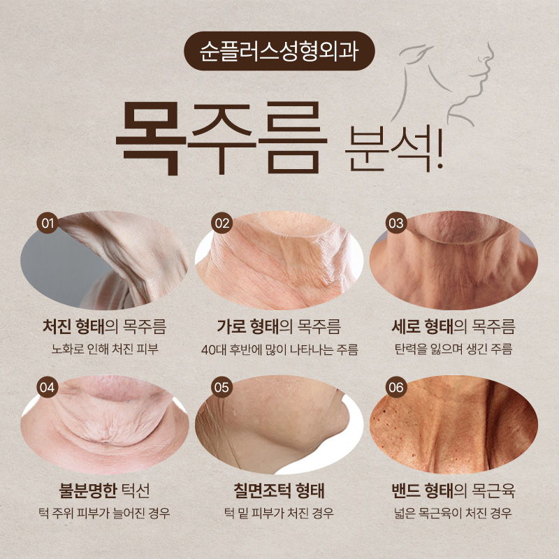 Neck Lift Surgery to Improve Sagging Neck and Neck Wrinkles image 3