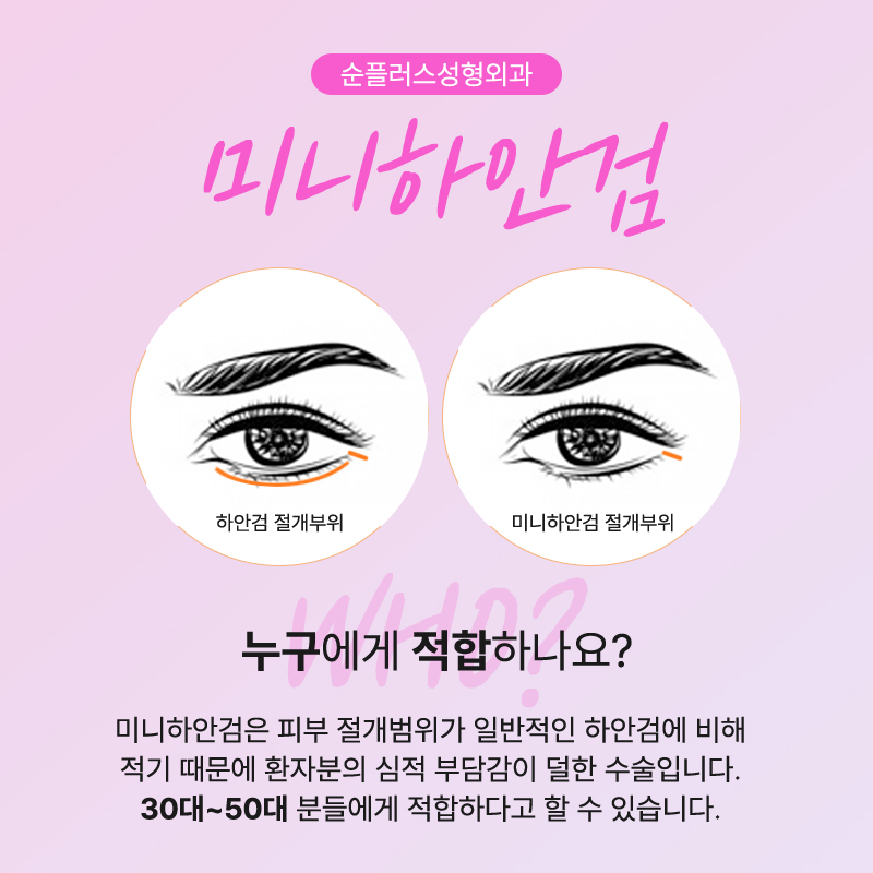 If Under-Eye Sagging Has Started: Mini Lower Blepharoplasty! image 3