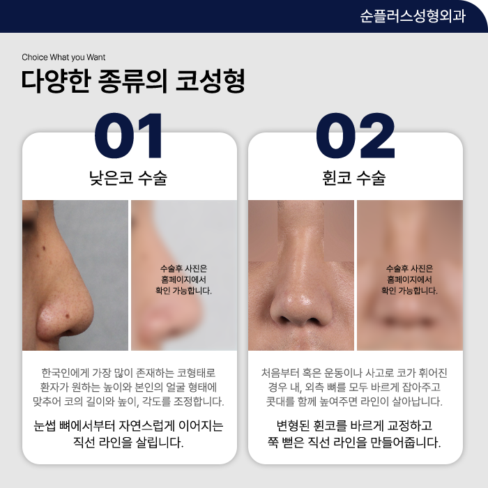 남자코성형잘하는곳 다른 이목구비까지 고려해야 관련 이미지 3