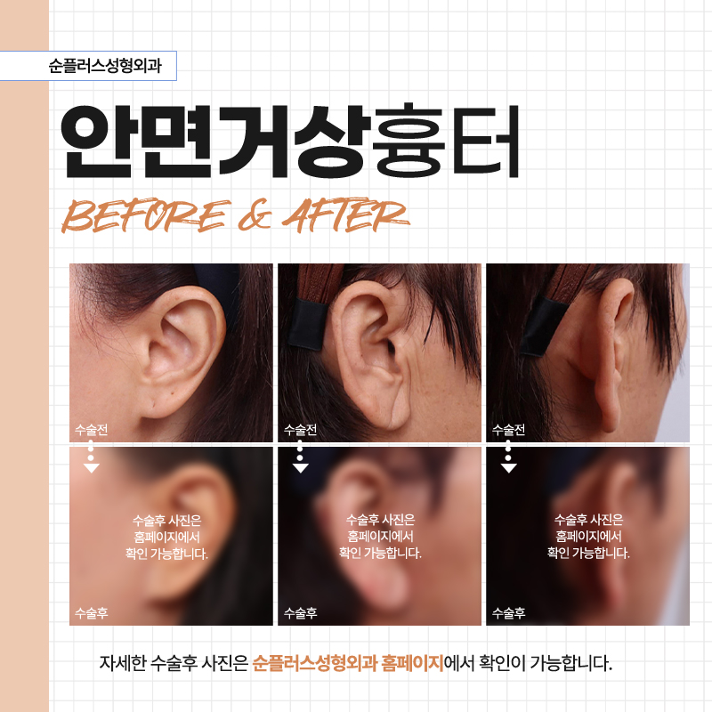 If You’re Having Difficulty Choosing a Facelift Hospital image 4